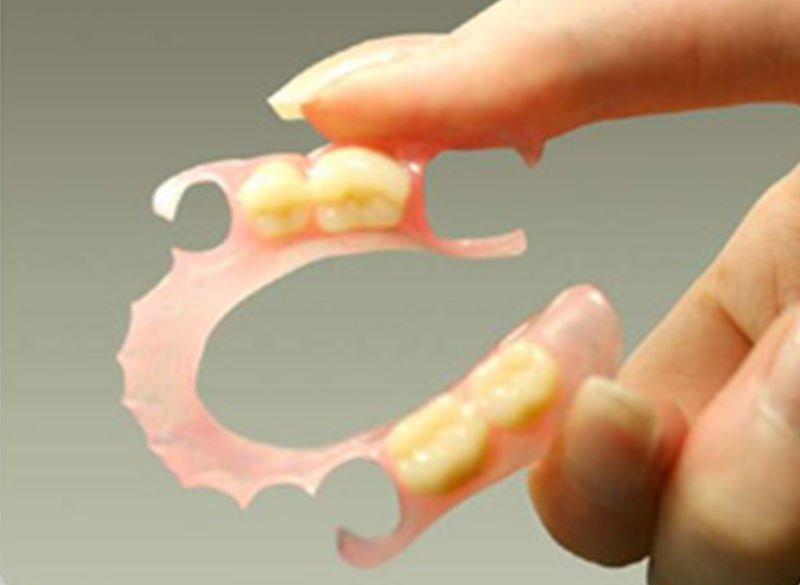 ナチュラルデンチャー(バネのない入れ歯)