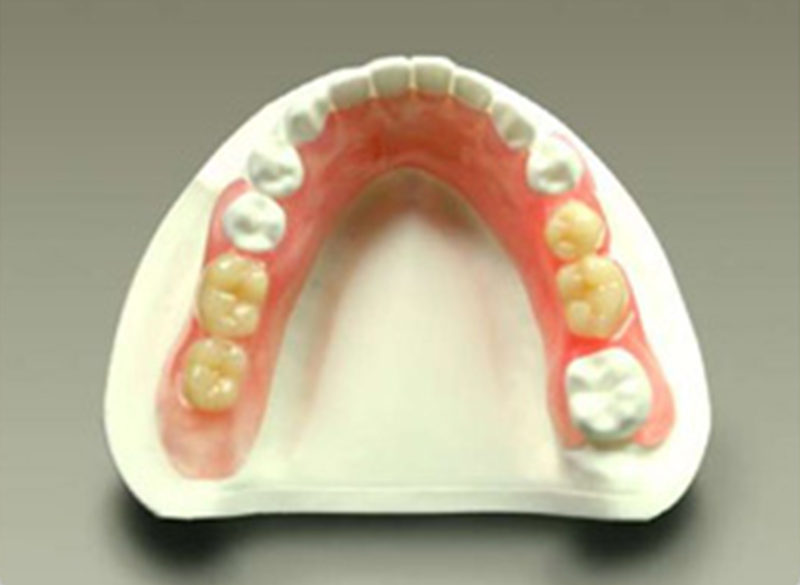 ナチュラルデンチャー(バネのない入れ歯)