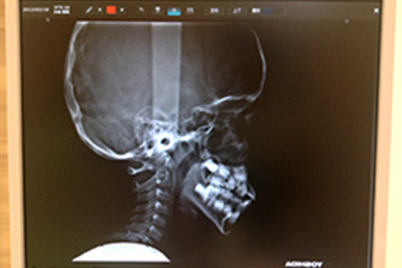 検査結果の説明